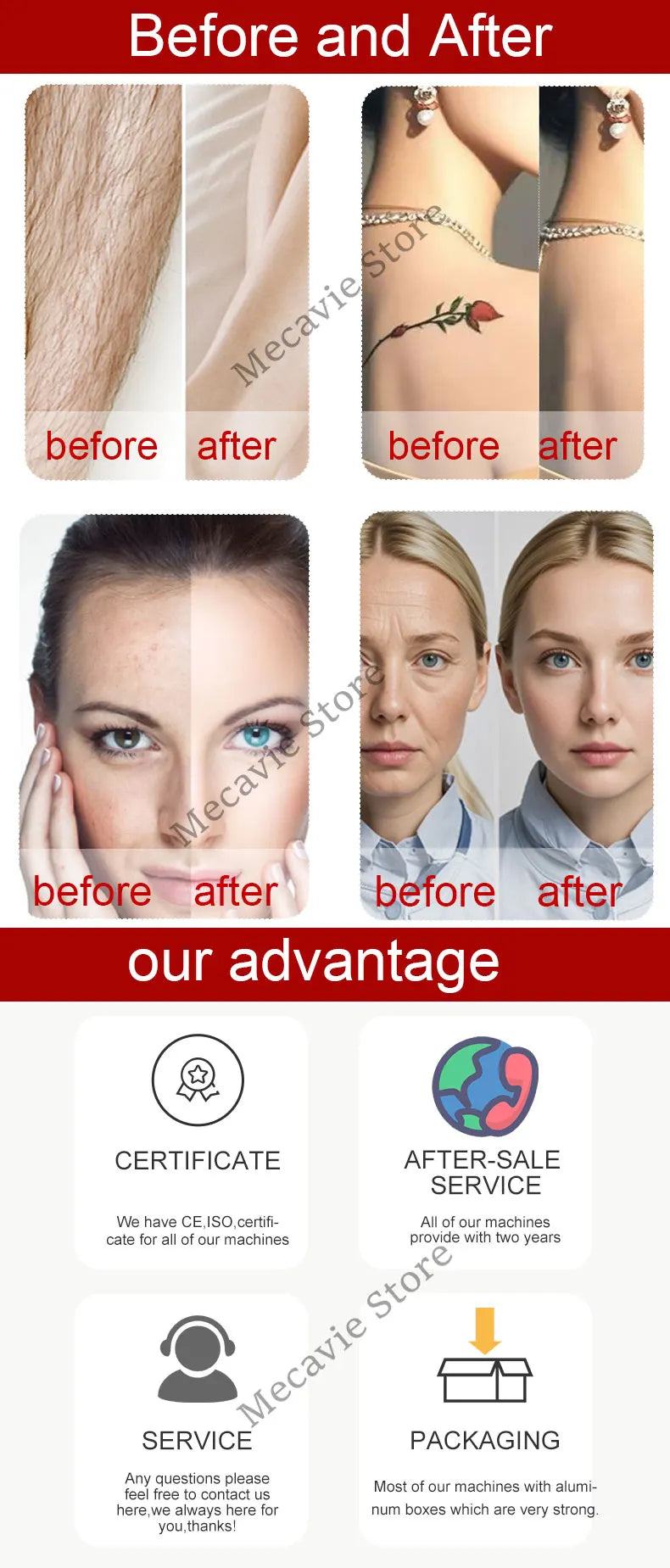 4in1 Soprano Titanium Ice Platinum RF Diode 755 808 940 1064nm 4 Wave Laser ND:YAG Machine Painless Hair Removal Machine 2025