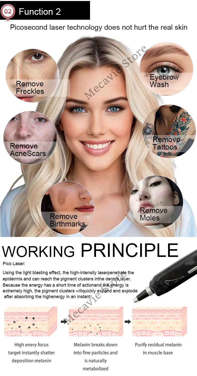 4in1 Soprano Titanium Ice Platinum RF Diode 755 808 940 1064nm 4 Wave Laser ND:YAG Machine Painless Hair Removal Machine 2025