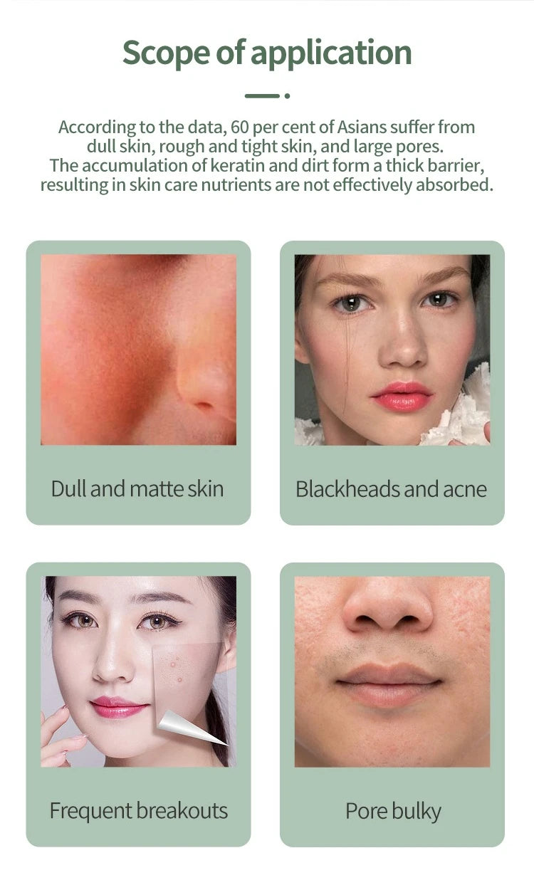 Deep Vibrate Skin Scrubber Facial Cleaner Shovel Spatula Not Ultrasonic Face ScrubberPeeling Blackhead Remover Facial Ma ssager