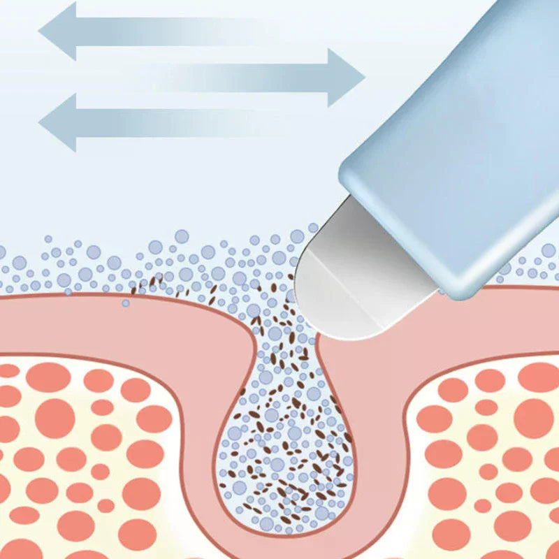 Deep Cleansing Blackhead And Whitehead Removal Tool For Nose And Face Skin Pore Cleaner Face Scraper Skin Care Beauty Tools