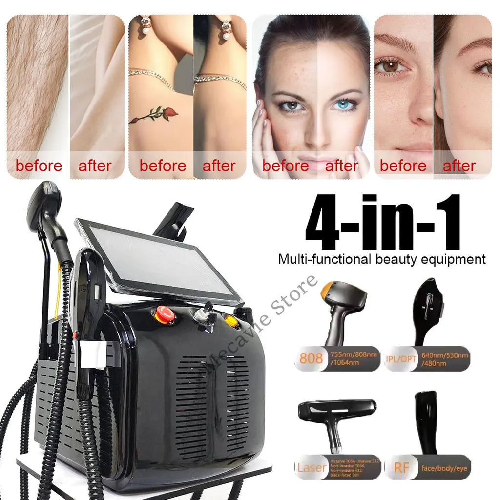 4in1 Soprano Titanium Ice Platinum RF Diode 755 808 940 1064nm 4 Wave Laser ND:YAG Machine Painless Hair Removal Machine 2025